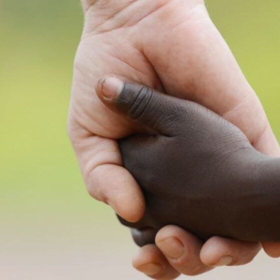 Which Type Of Rights Ensure Equal Treatment Under The Law?