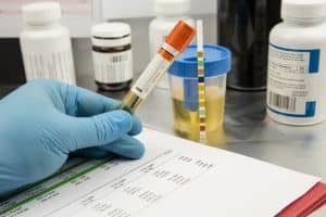 Do edibles show up in Drug Tests: Exploring the facts